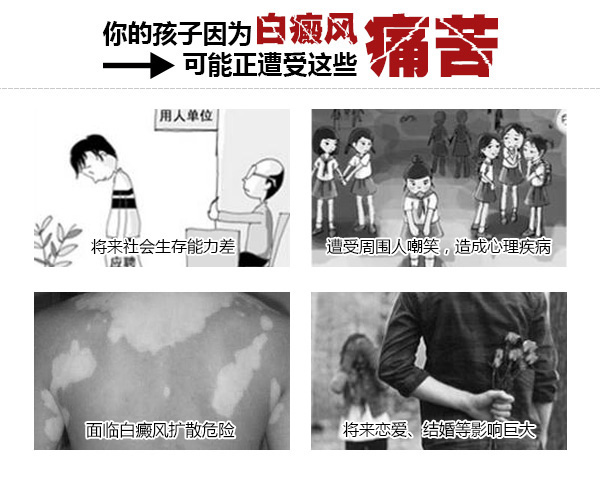 赣州小儿患上白癜风会有哪些危害?