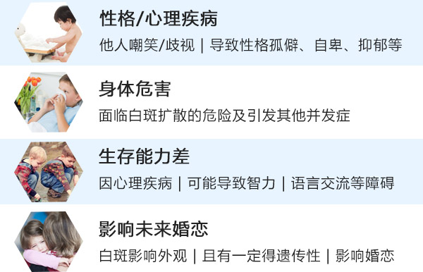 患白癜风以后会对患者有什么样的危害?