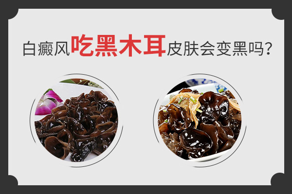 白癜风患者吃黑木耳有什么好处?