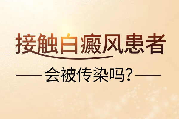 赣州白癜风给别人传染吗？