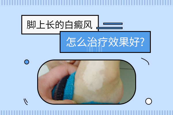足部白斑怎么治疗?
