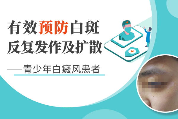 青少年白癜风能好起来吗?