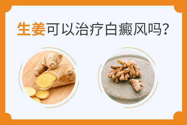 治疗白癜风可以使用生姜吗?