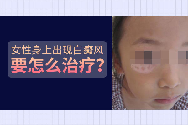 女性患上白癜风后需要注意什么? 