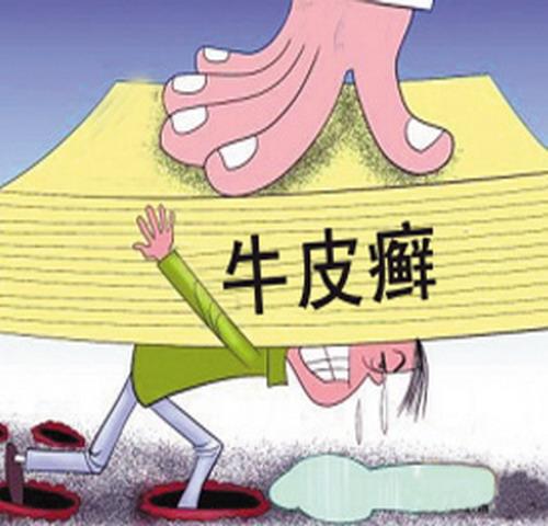 寻常型银屑病给孩子带来什么危害呢?