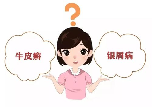 导致银屑病的主要因素有哪些?