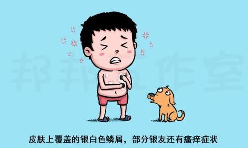 是什么原因导致孩子患上银屑病?