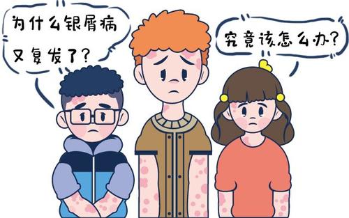如何减少或缓解银屑病的再发?