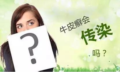 银屑病是否会传染给他人?