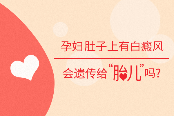 孕妇肚子上的白癜风会不会遗传给孩子?