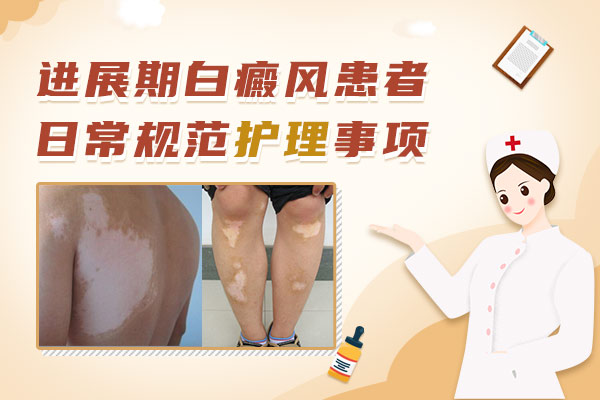 白癜风范围扩大怎么办?